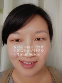 .東暉微整培訓學校為你解答各種整形術后恢_商務服務_世界工廠網