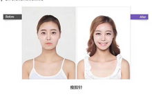 臨沂正規微整形培訓學校的選擇與注意事項