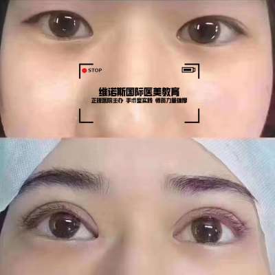 甘肅微整形培訓學校指南