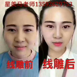 鄭州星美國際醫美教育 專業的微整形培訓學校